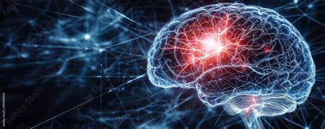 Cerebrovascular Neurology: