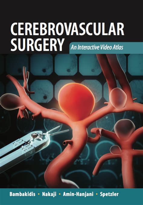 Cerebrovascular Surgery Toward a New Research Strategy Reader