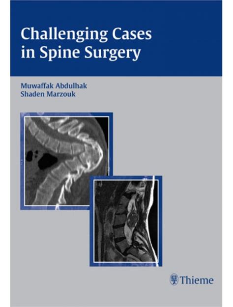 Challening Cases in Spine Surgery Reader