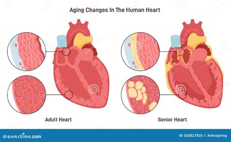 Changes of the Heart Doc