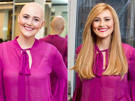 Chemotherapy Wigs: A Comprehensive Guide