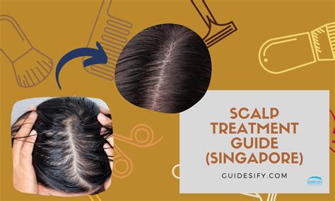 Cheng Jun Singapore: A Comprehensive Guide to the Leading Hair and Scalp Clinic