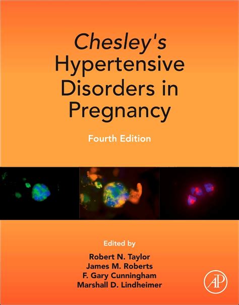 Chesley's Hypertensive Disorders in Pregnancy Kindle Editon