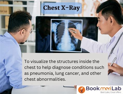 Chest X-Ray Cost: Uncovering the Price of Essential Imaging