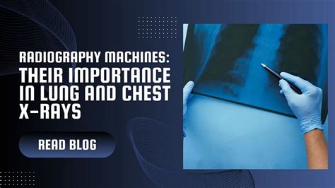 Chest X-rays: A Vital Diagnostic Tool