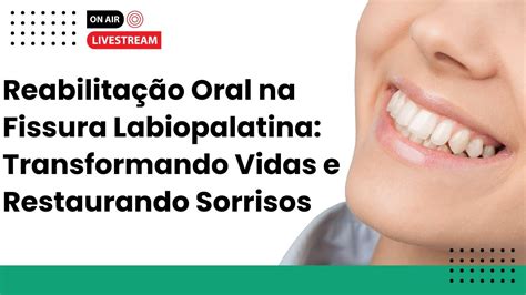 Clínica Millenium Santa Maria: Transformando Vidas e Restaurando Sorrisos