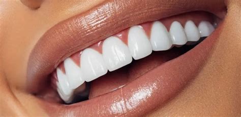 Clareamento a Laser no Consultório: Um Guia Completo para um Sorriso Mais Branco