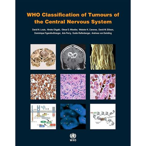 Classification Tumours Central Nervous System Epub