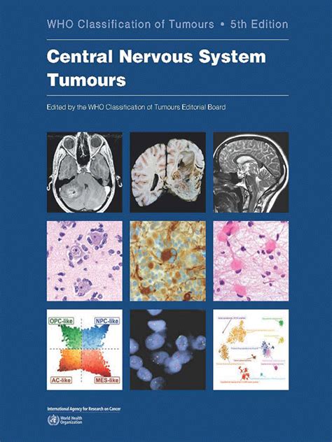 Classification Tumours Central Nervous System Kindle Editon