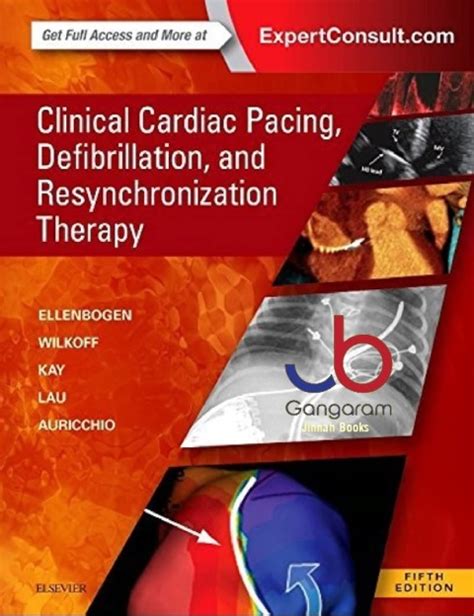 Clinical Cardiac Pacing Epub