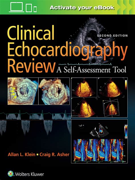 Clinical Echocardiography Review: A Self-Assessment Tool Ebook Epub