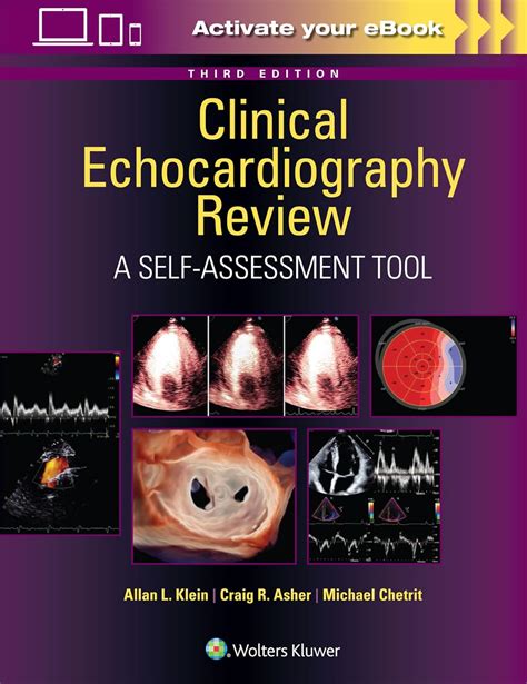 Clinical Echocardiography Review: A Self-Assessment Tool Ebook Epub