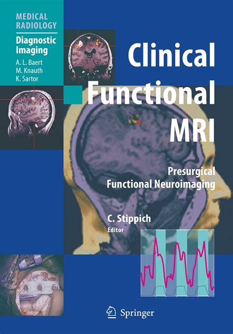 Clinical Functional MRI Presurgical Functional Neuroimaging 1st Edition Kindle Editon