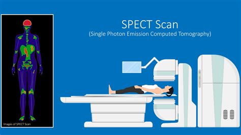 Clinical Spect Imaging Doc