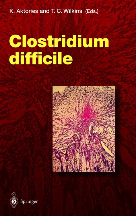 Clostridium difficile (Current Topics in Microbiology and Immunology) 1st Edition Kindle Editon