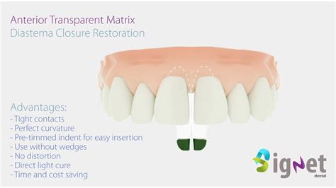 Closure Restoration: A Comprehensive Approach