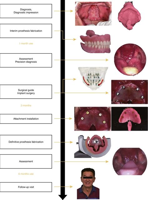 Closure vs. Frontal: A Guide to Maxillofacial Prostheses