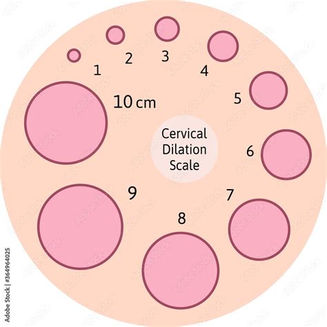 Cm Dilation Chart