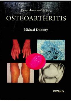 Color Atlas and Text of Osteoarthritis PDF