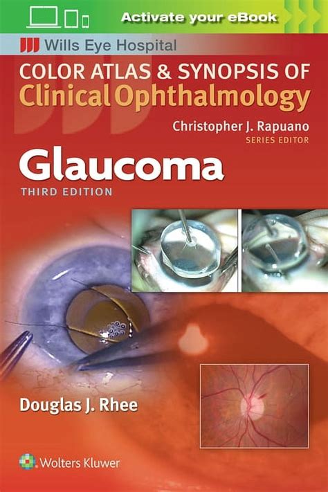 Color Atlas of Glaucoma PDF