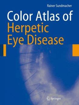 Color Atlas of Herpetic Eye Disease A Practical Guide to Clinical Management PDF