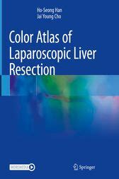 Color Atlas of Laparoscopic Surgery PDF