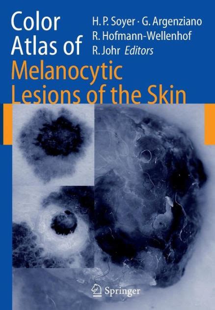 Color Atlas of Melanocytic Lesions of the Skin 1st Edition PDF