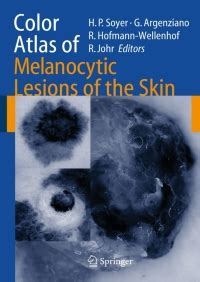 Color Atlas of Melanocytic Lesions of the Skin 1st Edition PDF