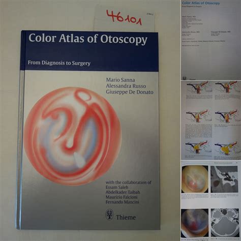 Color Atlas of Otoscopy From Diagnosis to Surgery 2nd Edition Epub