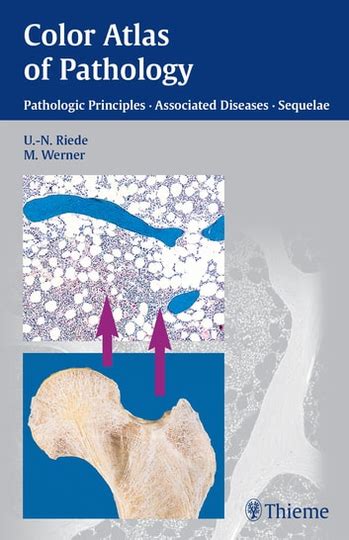 Color Atlas of Pathology Pathologic Principles Reader