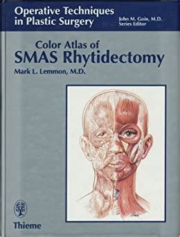 Color Atlas of SMAS Rhytidectomy Ebook Kindle Editon