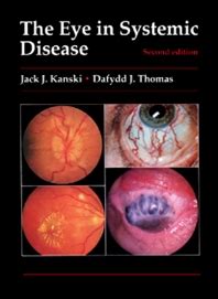 Color Atlas of the Eye in Systemic Disease Doc