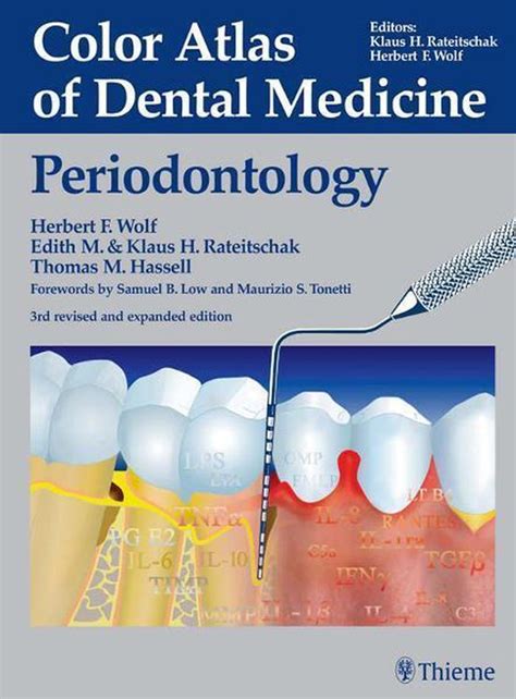 Color.atlas.of.periodontology Ebook PDF