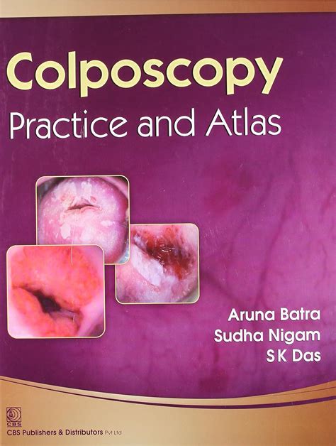 Colposcopy Practice and Atlas Kindle Editon