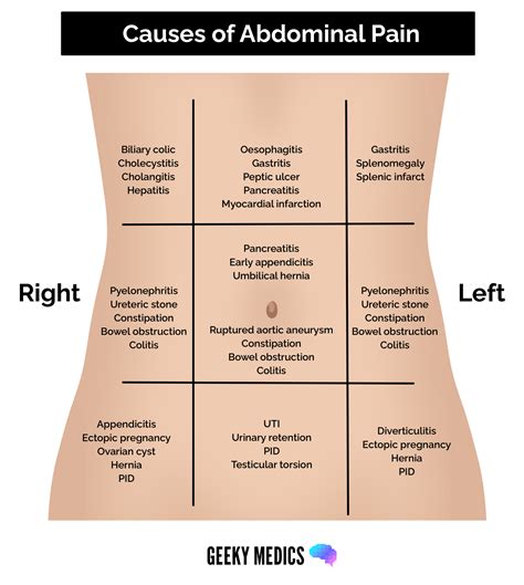 Common Causes of Abdominal Pain