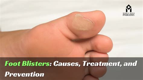 Common Causes of Blisters Under Toenails