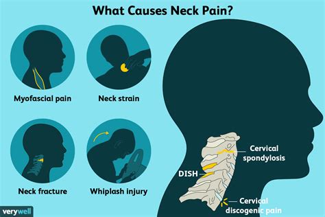 Common Causes of Neck Pain When Looking Up