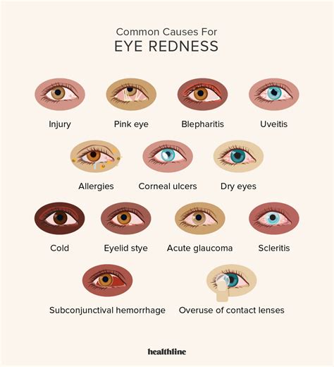 Common Causes of Pain and Redness in One Eye