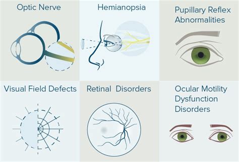 Common Problems in Neuroophthalmology PDF