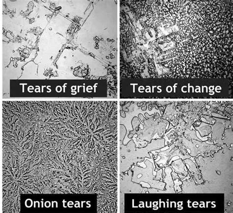 Composition of Tear Crystals: