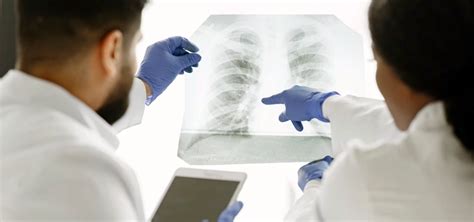 Comprehensive Guide: Understanding Polyclinic X-Ray Charges