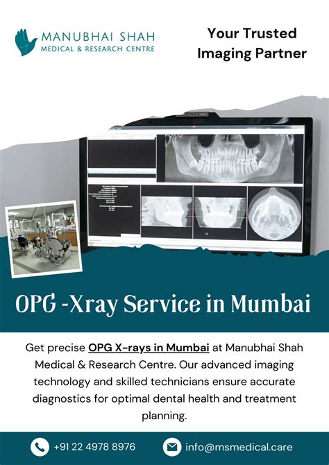 Comprehensive Guide to Boon Lay X-Ray Centre: Your Trusted Medical Imaging Partner