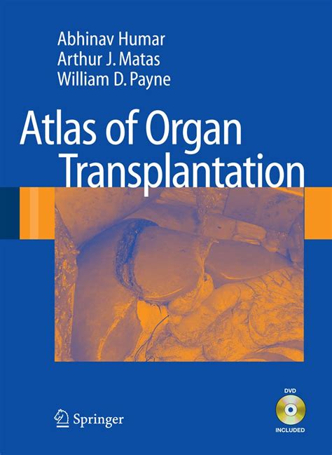 Comprehensive.Atlas.of.Transplantation Ebook Reader