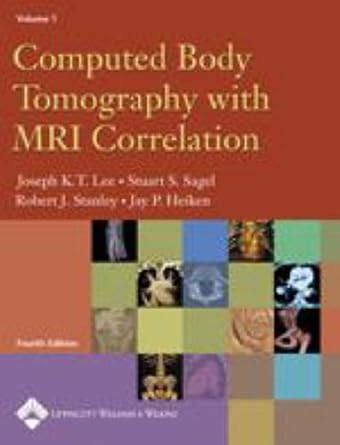 Computed Body Tomography with MRI Correlation PDF