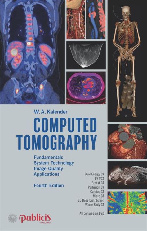 Computed Tomography Fundamentals Kindle Editon