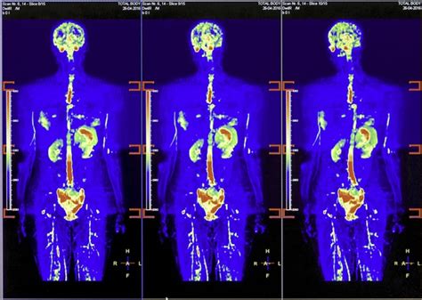 Computed Tomography and Magnetic Resonance Imaging of the Whole Body Kindle Editon