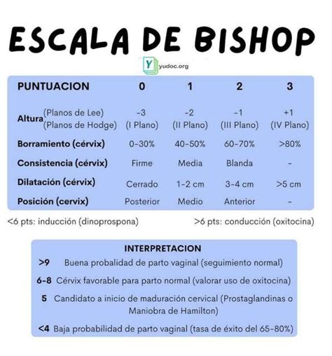 Conceitos Básicos da Bishop Escala