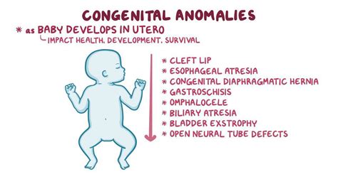 Congenital Conditions: