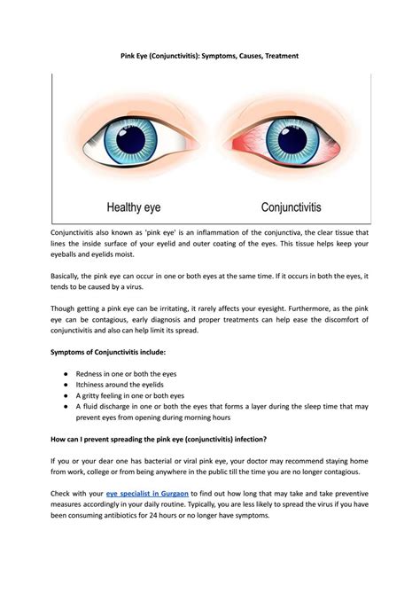 Conjunctivitis ä¸­æ–‡: The Ultimate Guide to Symptoms, Causes, and Treatment