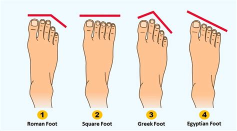 Consider Your Foot Type